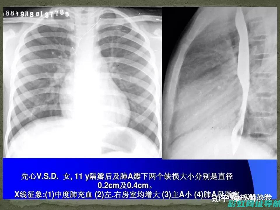 车辆心脏大换血