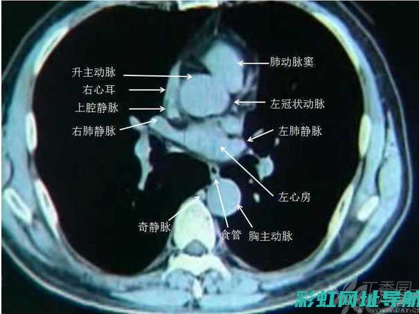 深入了解CT发动机：技术特点、使用经验与维护保养 (深入了解操作系统 pdf)