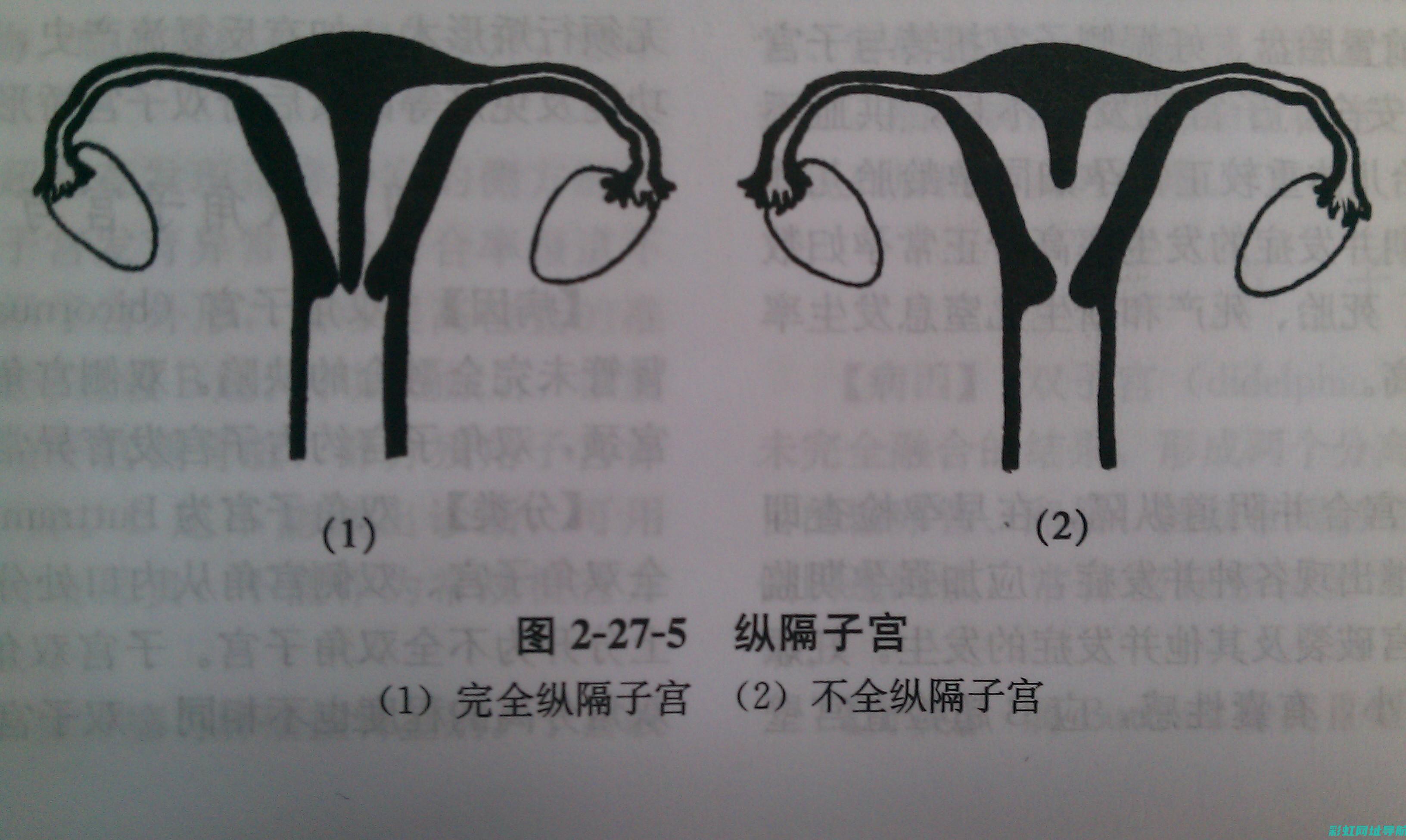 全面解析：如何应对发动机拉缸问题？维修与保养指南 (全面解析如何删除元素)